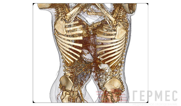   Anatomage ()