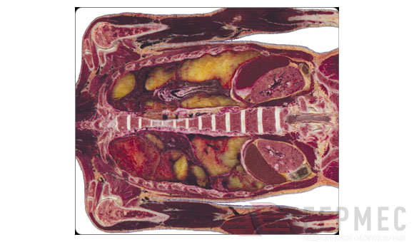    Anatomage ()