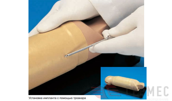 Рука для отработки  имплантации RITA™ 12606